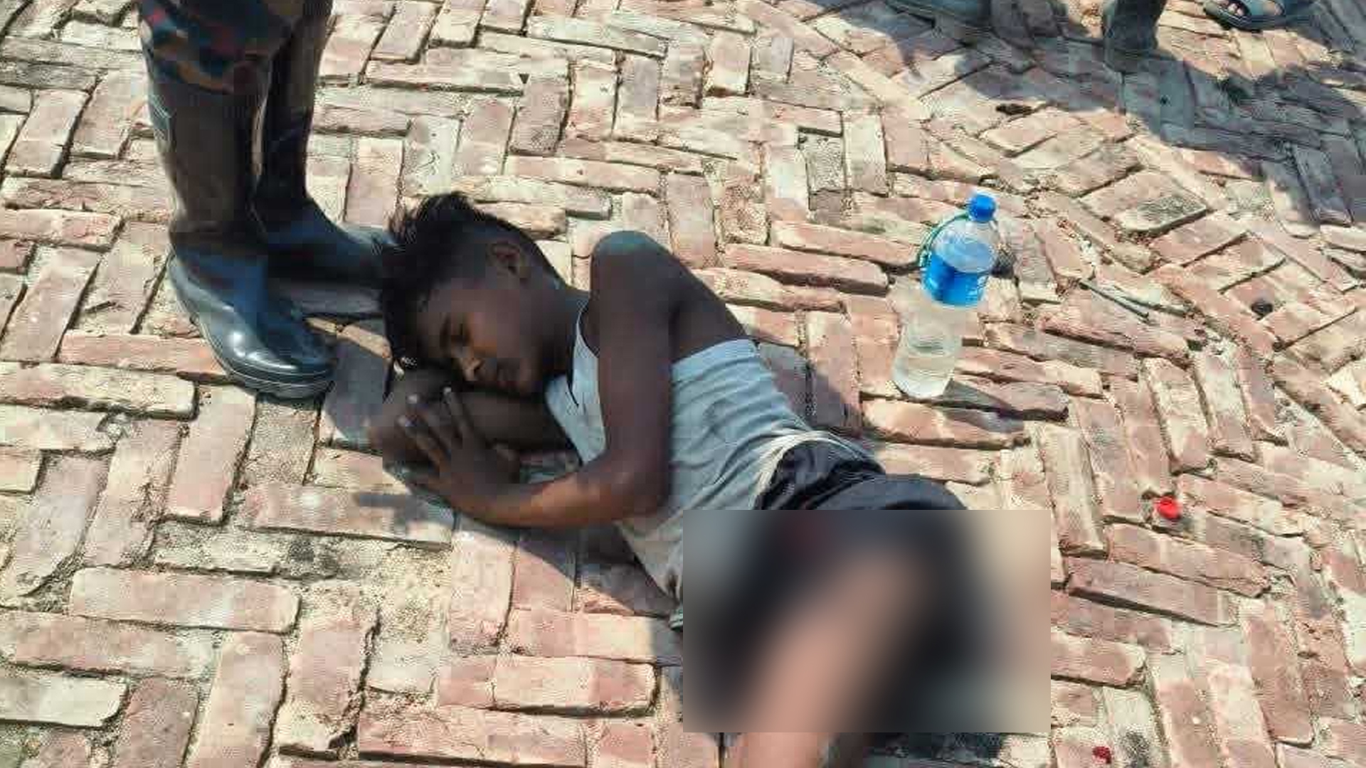 নাফ নদীতে মাছ ধরে তীরে উঠতে না উঠতেই মাইন বিস্ফোরণে পা বিচ্ছিন্ন রোহিঙ্গা কিশোরের