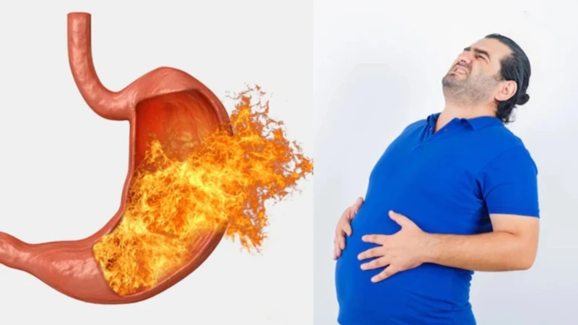 গ্যাস, অ্যাসিডিটিসহ পেটের সমস্যার মুক্তিতে করণীয়