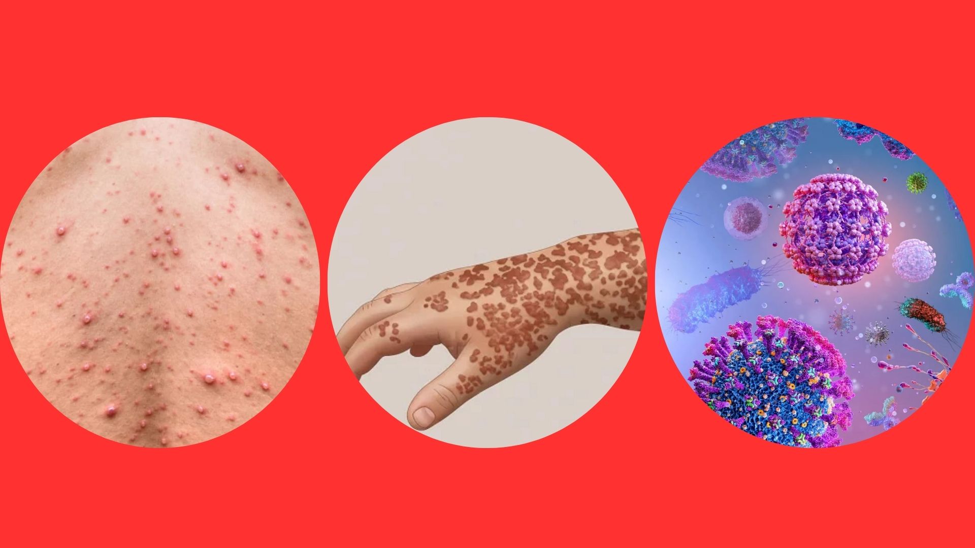 হাম ও অন্যান্য সংক্রামক ব্যাধি থেকে বাঁচার দোয়া