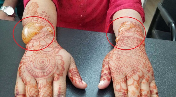 মেহেদিতে পুড়ল নারীর হাত, লাখ টাকা জরিমানা