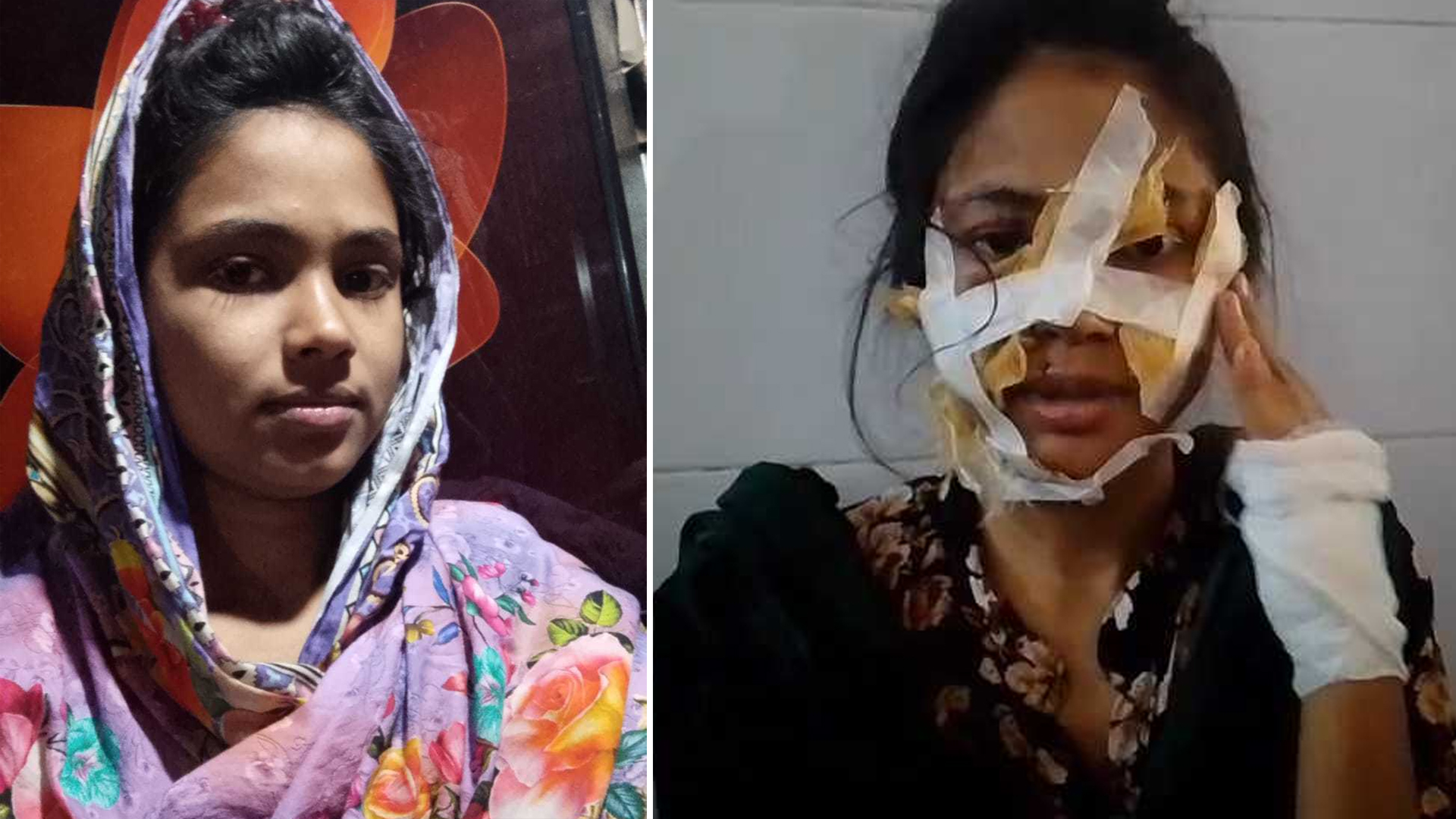 নড়াইলে ডিভোর্স দেয়ায় গৃহবধূ উপর হামলা, শরীরে অর্ধশত সেলাই