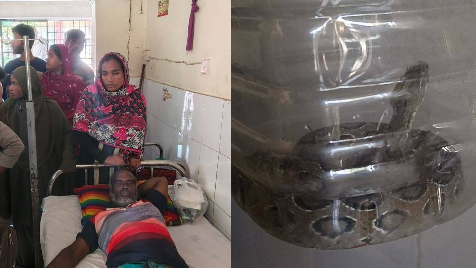 দংশন করা সাপ বোতলে ভরে হাসপাতালে ভর্তি কৃষক