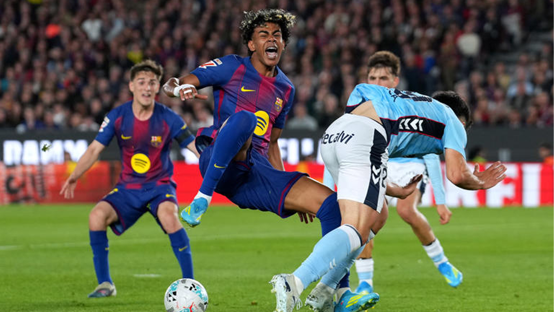 গোল করার পর ইনজুরি নিয়ে মাঠ ছাড়লেন ইয়ামাল