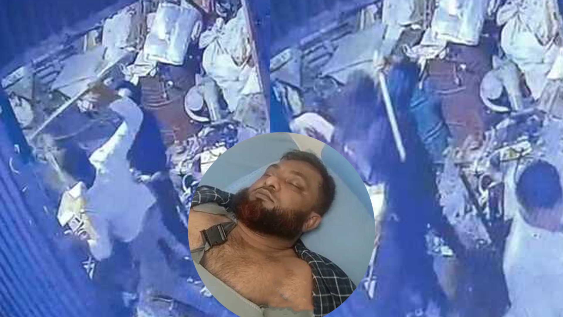 চাঁদা না দেয়ায় ব্যবসায়ীর হাত ভেঙে দিল সন্ত্রাসীরা, ভিডিও ভাইরাল