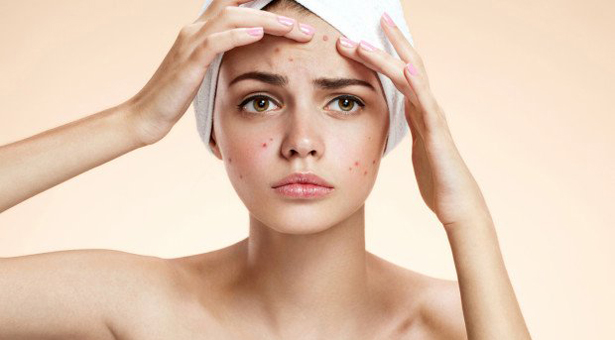 এক রাতে ব্রণ দূর করার উপায়: প্রাকৃতিক টিপস ও ট্রিকস