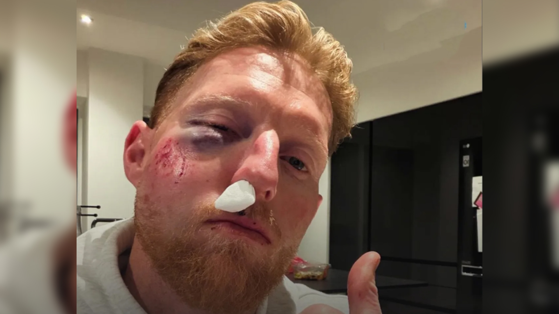 বলের আঘাতে আহত স্টোকস