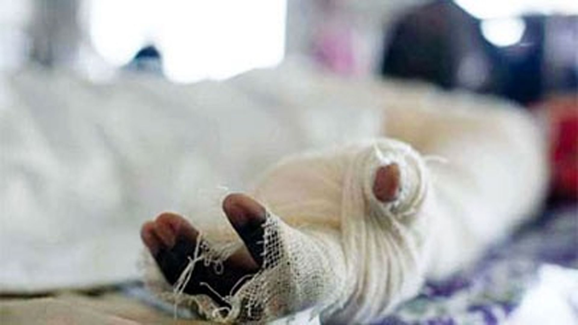 চট্টগ্রামে বিস্ফোরণ: দগ্ধ ১০ জনের পুড়েছে শ্বাসনাল...