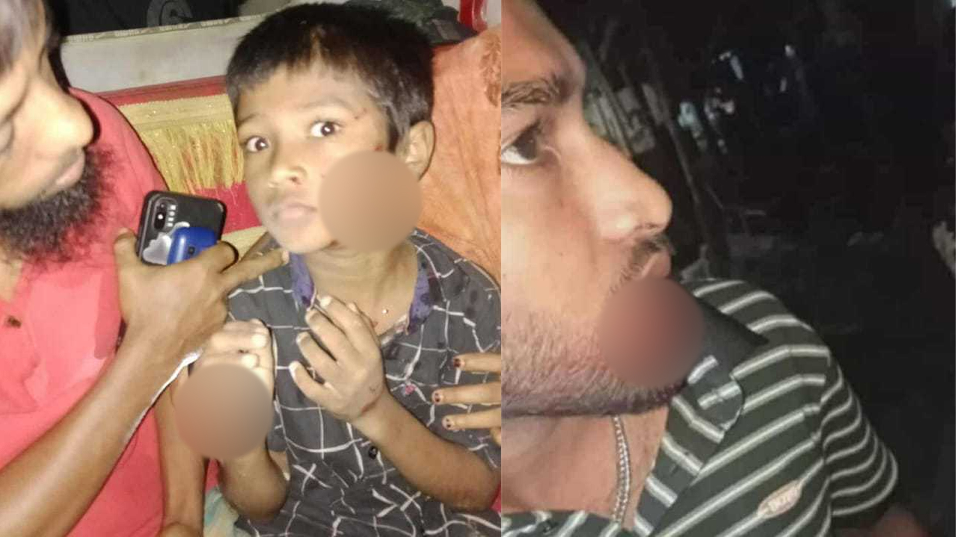 কুমিল্লায় শিয়ালের কামড়ে শিশুসহ আহত ৭
