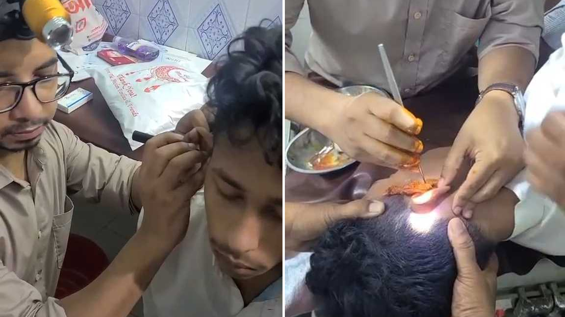 পুলিশের ভয়ে কানের ভেতর ইয়াবা, ৯ দিন পর অস্ত্রোপচার