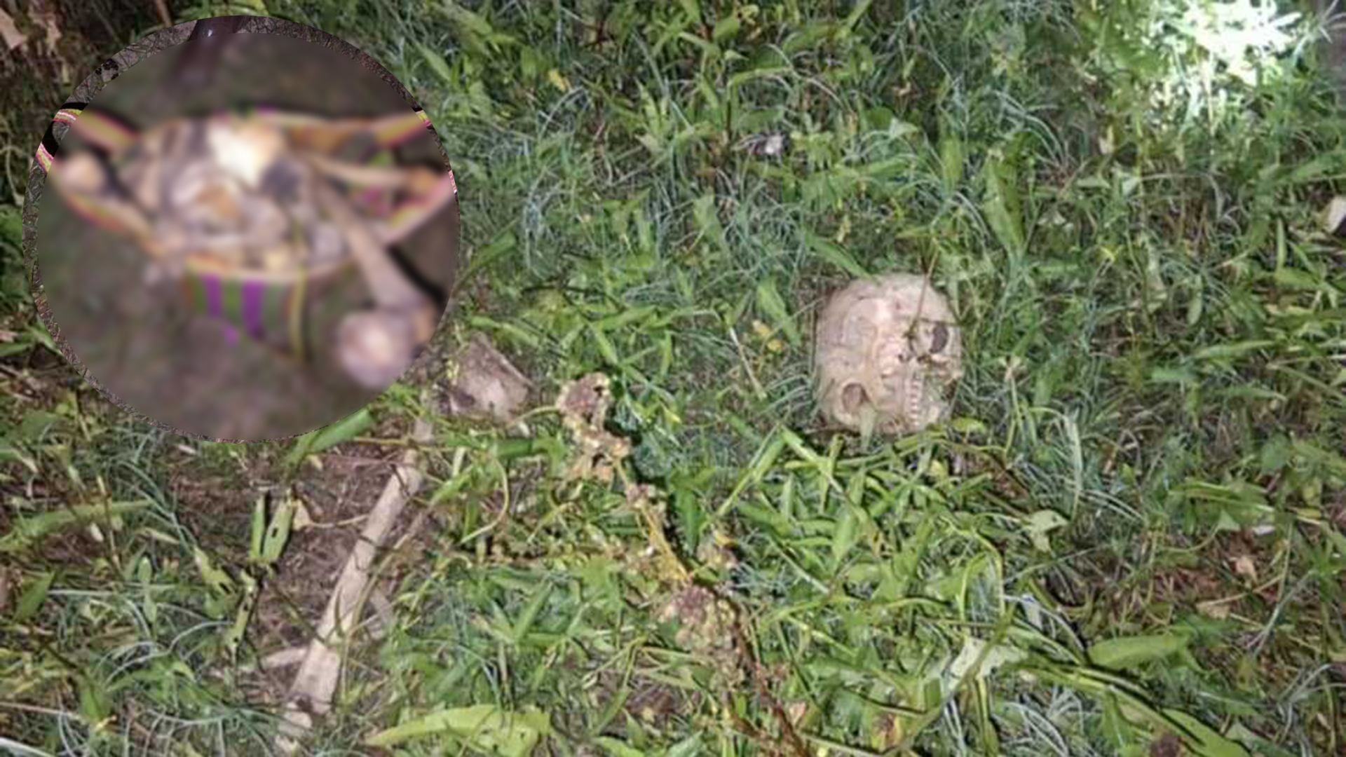 বিলে কচুরিপানায় মিলল মানুষের কঙ্কাল