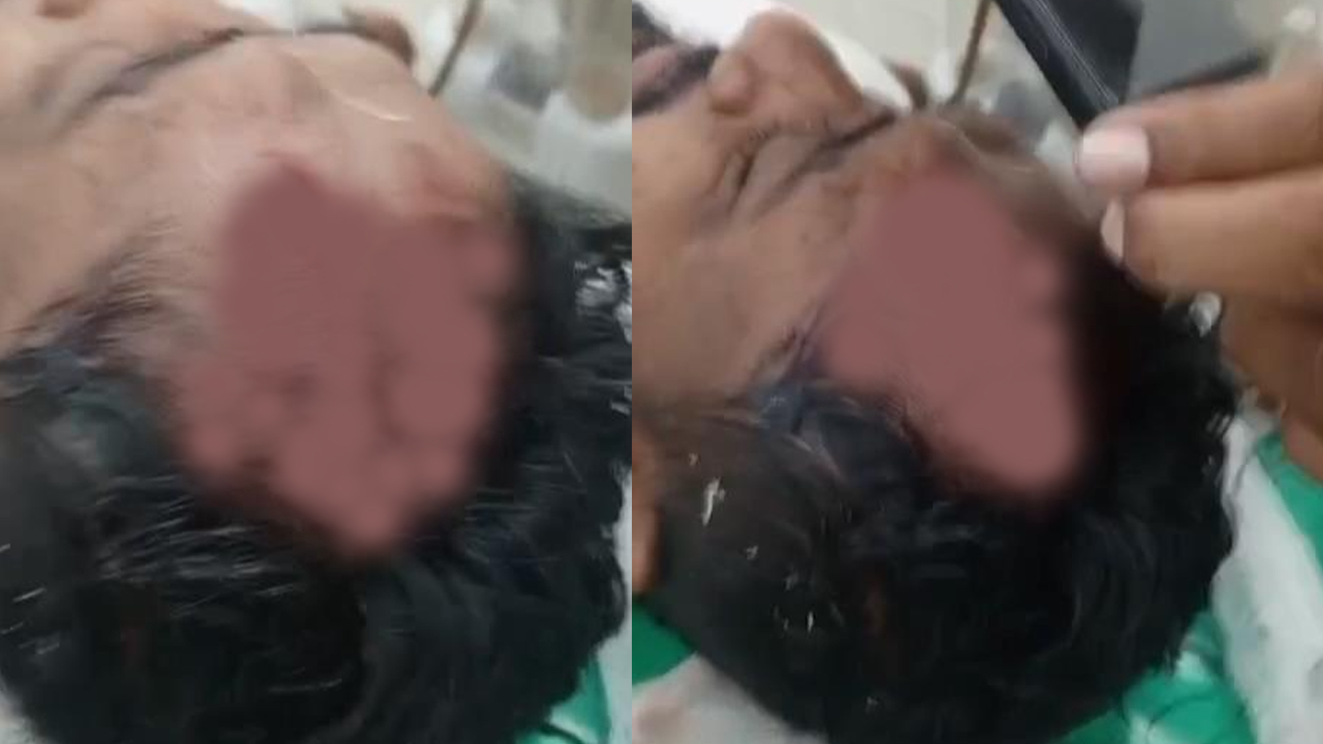 তদন্তে আসা পুলিশ সদস্যকে কুপিয়ে জখম
