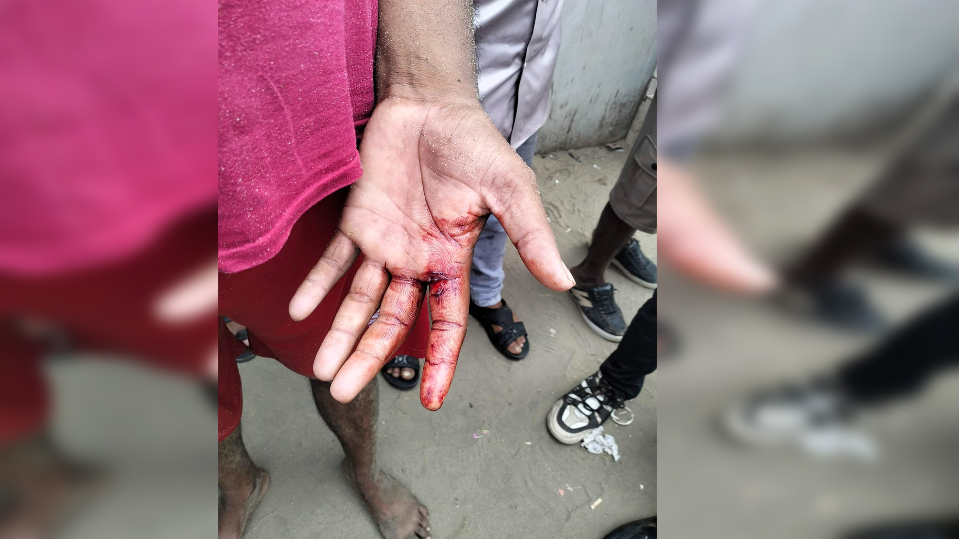 কক্সবাজার সৈকতে পর্যটককে পিটিয়ে জখম করলো হকাররা