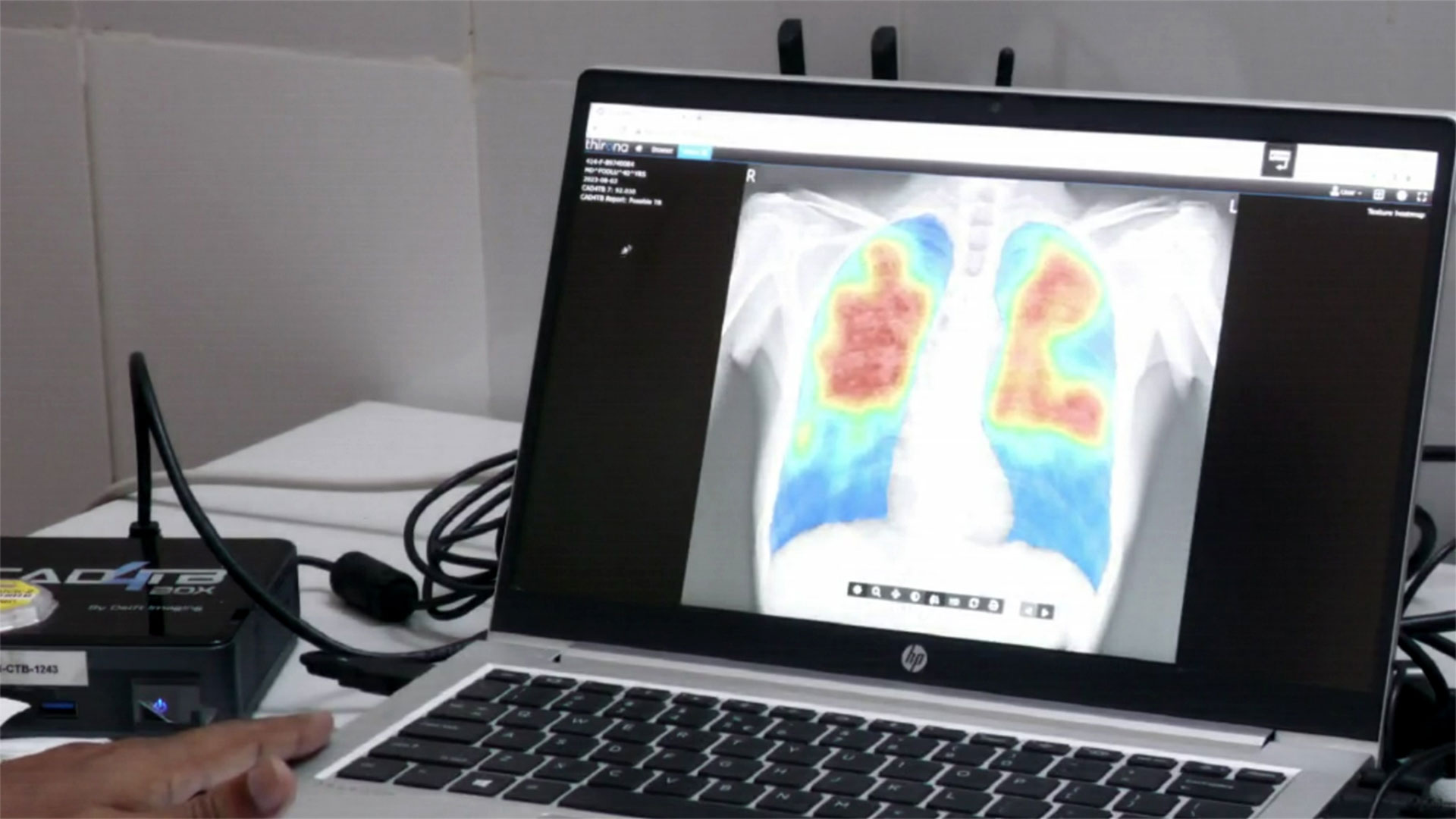 Ornella Muti jinsiy aloqa video