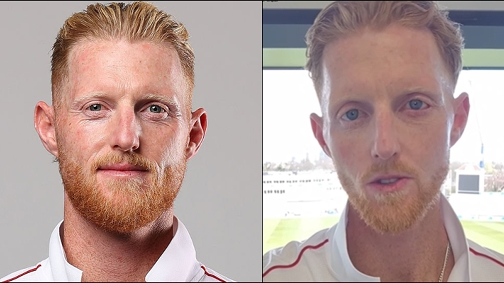 ভয়াবহ দুর্ঘটনার পর বদলে গেছে বেন স্টোকসের চেহারা