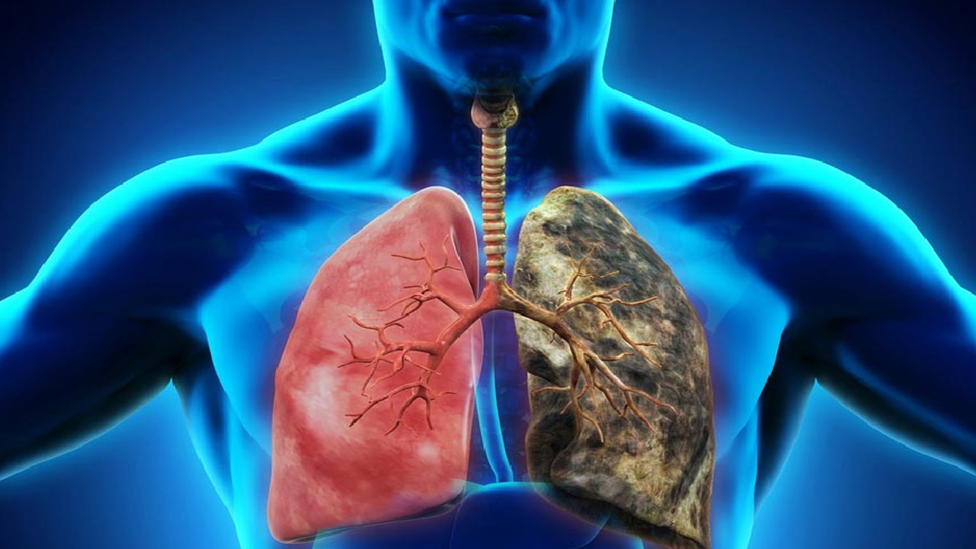 ফুসফুস ভালো রাখার ঘরোয়া ১০ উপায়