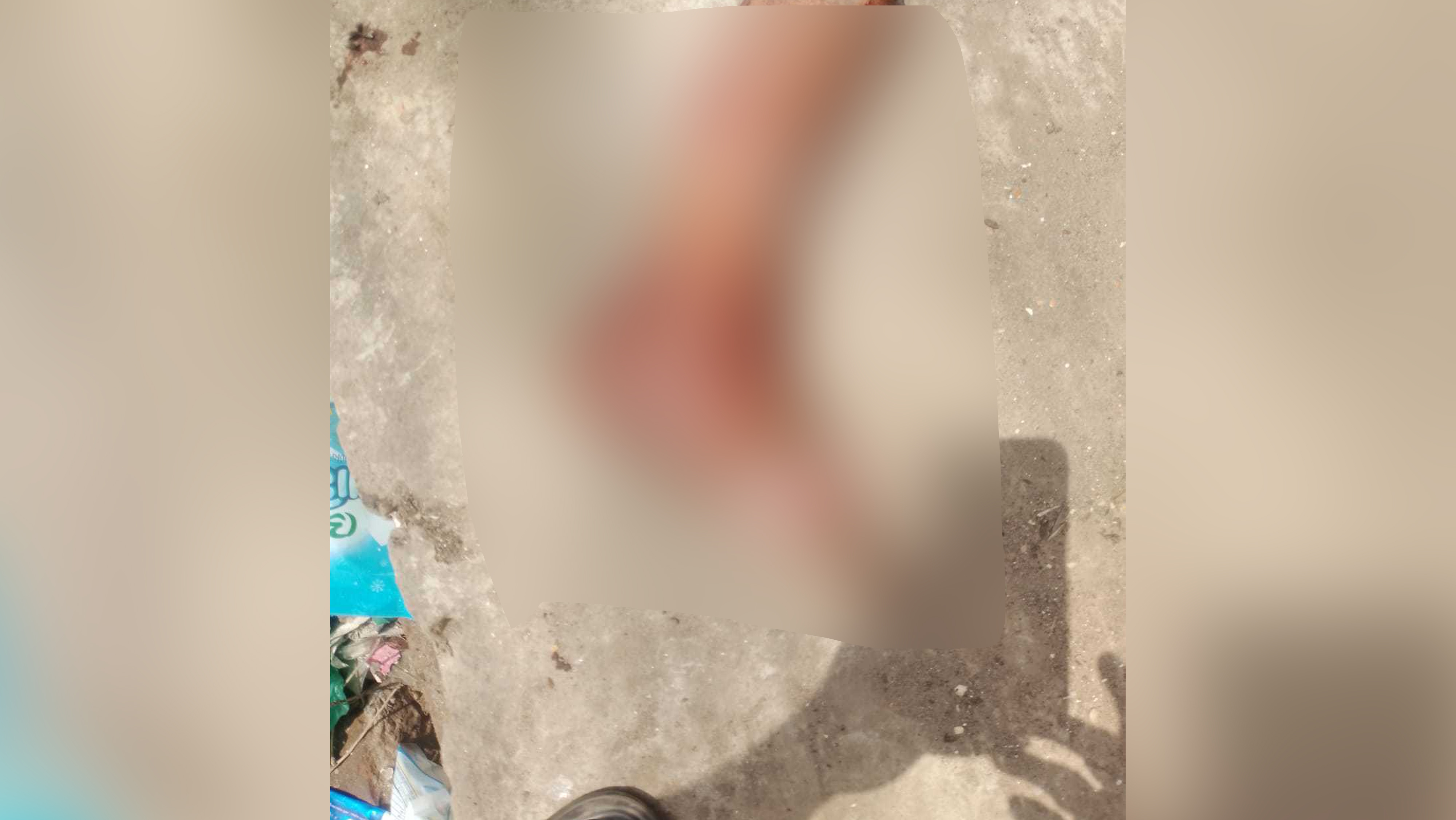 কুমিল্লায় ময়লার ট্যাংক থেকে পাওয়া কাটা পা কার?