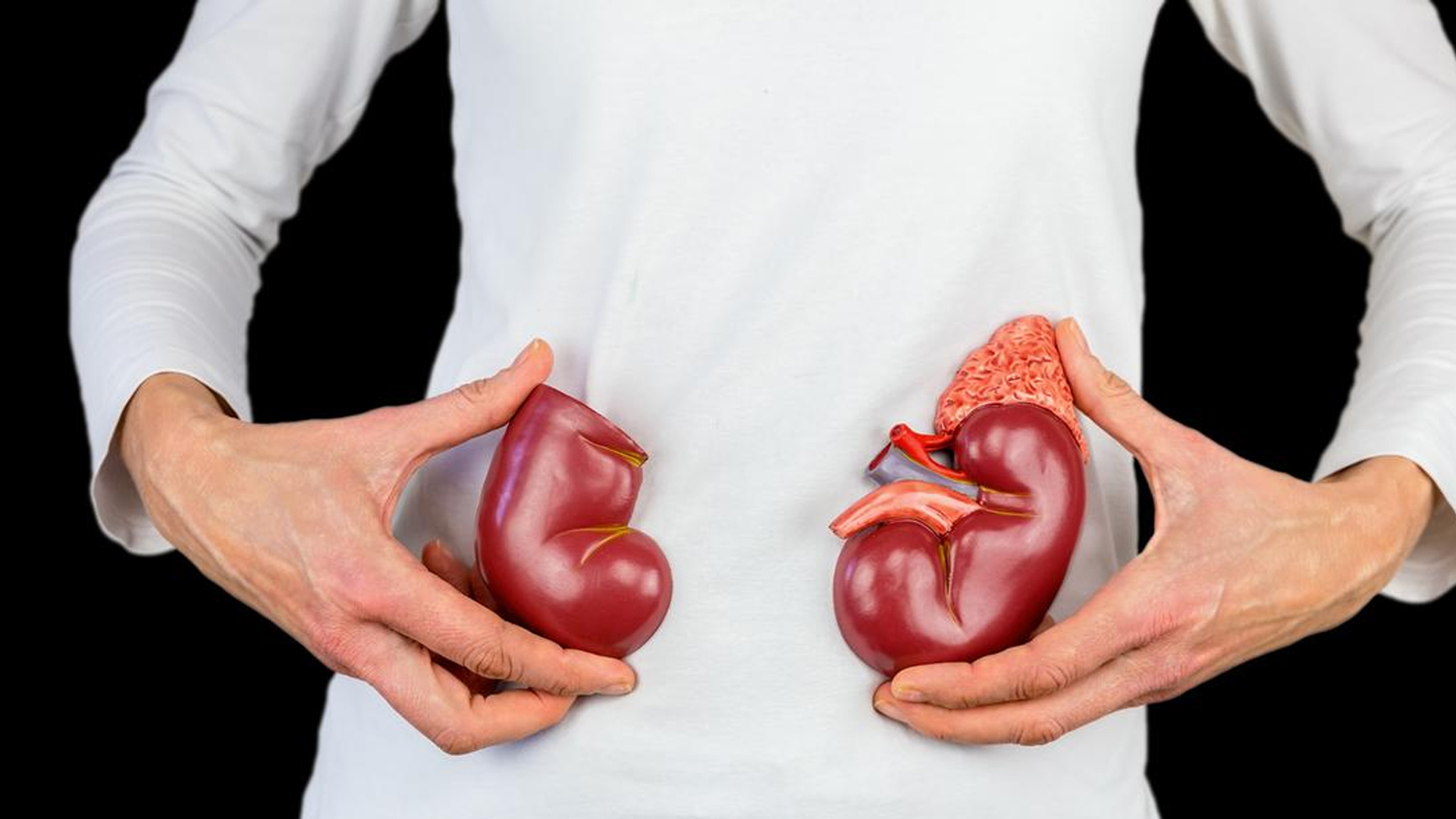 Moskvada mavzuli jinsiy partiyalar