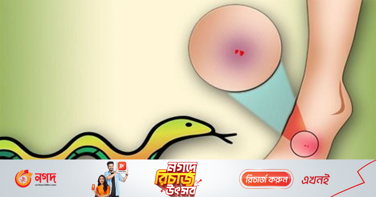 সিলেটে সাপের উপদ্রব বাড়লেও নেই অ্যান্টিভেনম | বাংলাদেশ সিলেটে সাপের উপদ্রব বাড়লেও নেই অ্যান্টিভেনম | বাংলাদেশ