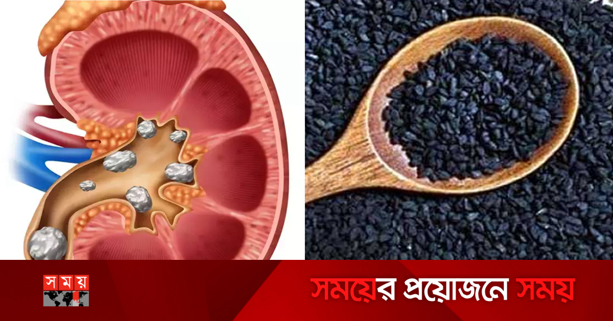 Qidiruv: Odamlarning sikilayotgani haqidagi videolarni tomosha qiling